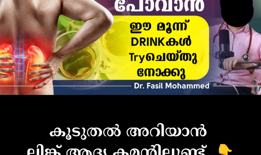 Main causes of kidney stones