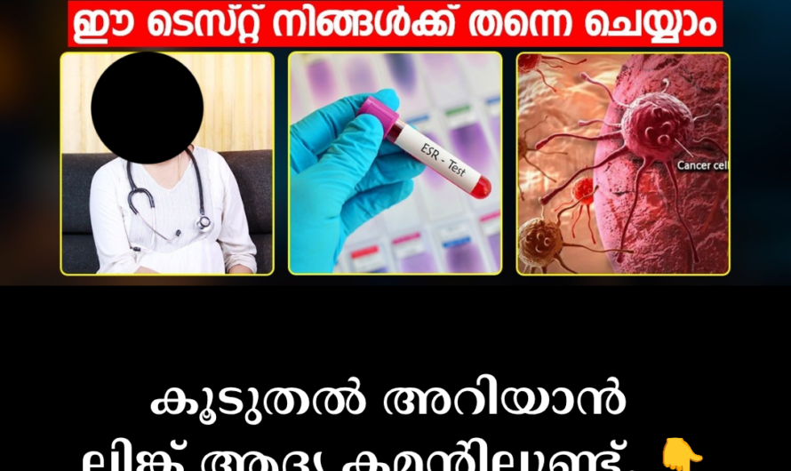 Risk Factors for Cancer