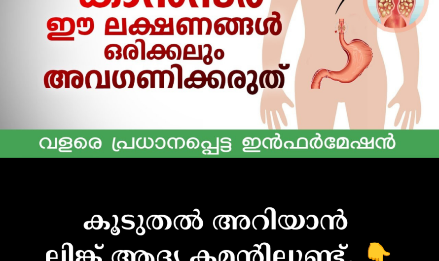 The main causes of stomach cancer are given below: