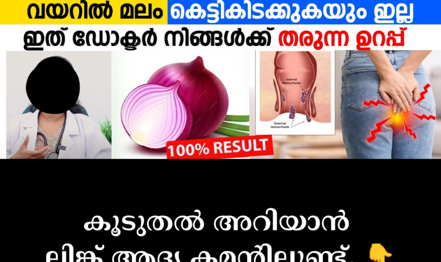 Main causes of hemorrhoids