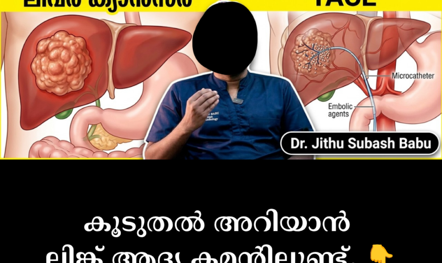 The main reasons for liver cancer are given below: