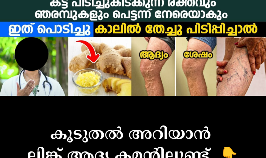 The main causes of varicose veins are as follows:
